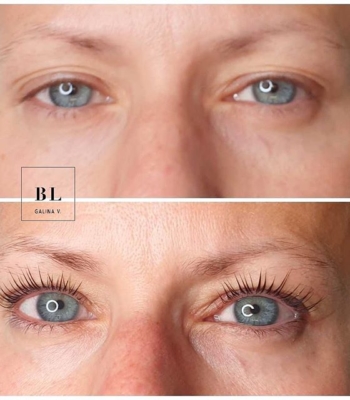 InLei -taivutus???? #blgalinav #bluelagoonbeauty #inlei #inleilashfiller