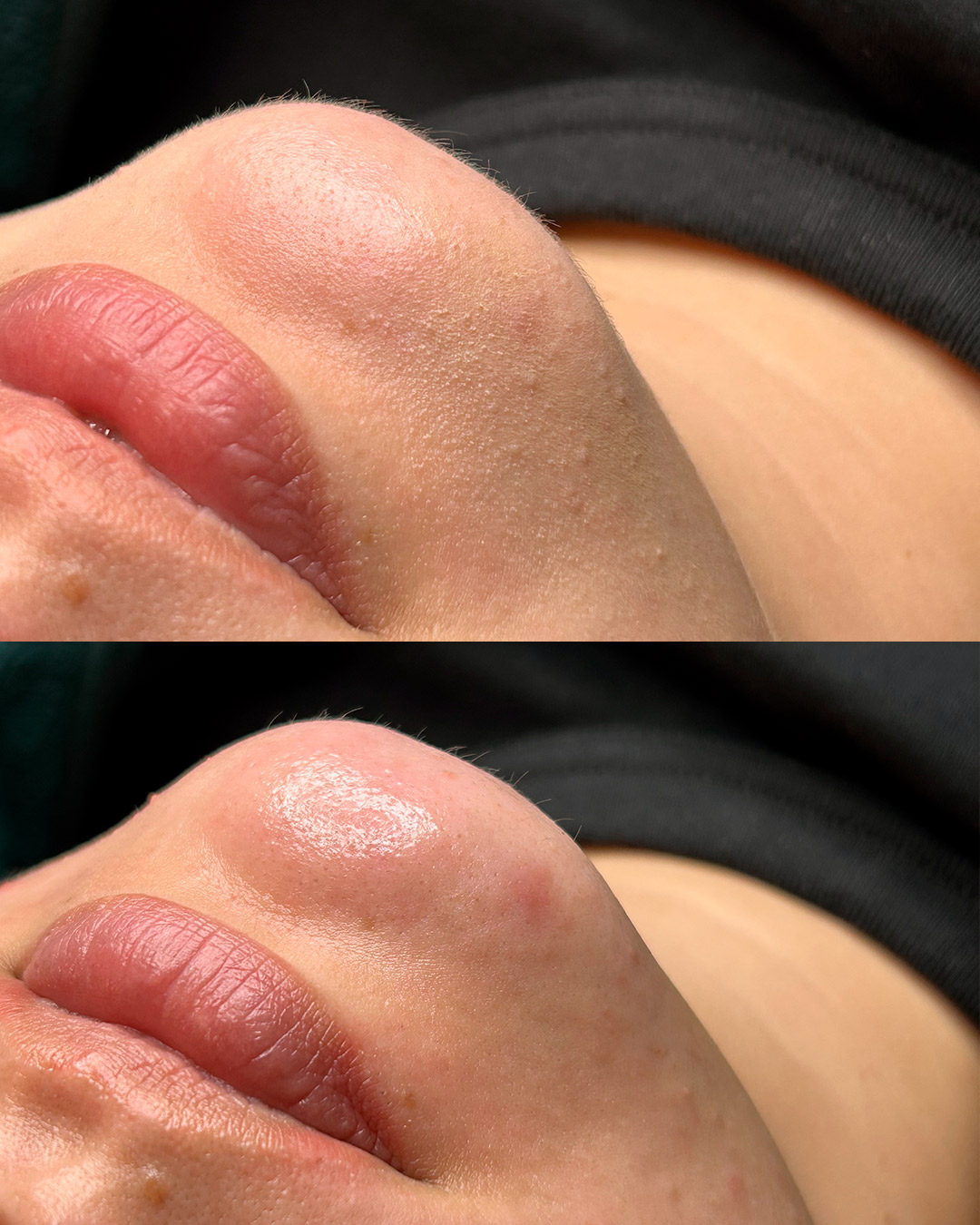 Tämän kuvan nimi on hydrafacial-mercedesh-kamppi