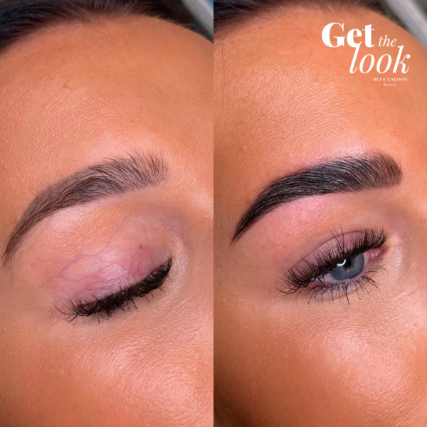 Brow Lift Sara Siepille