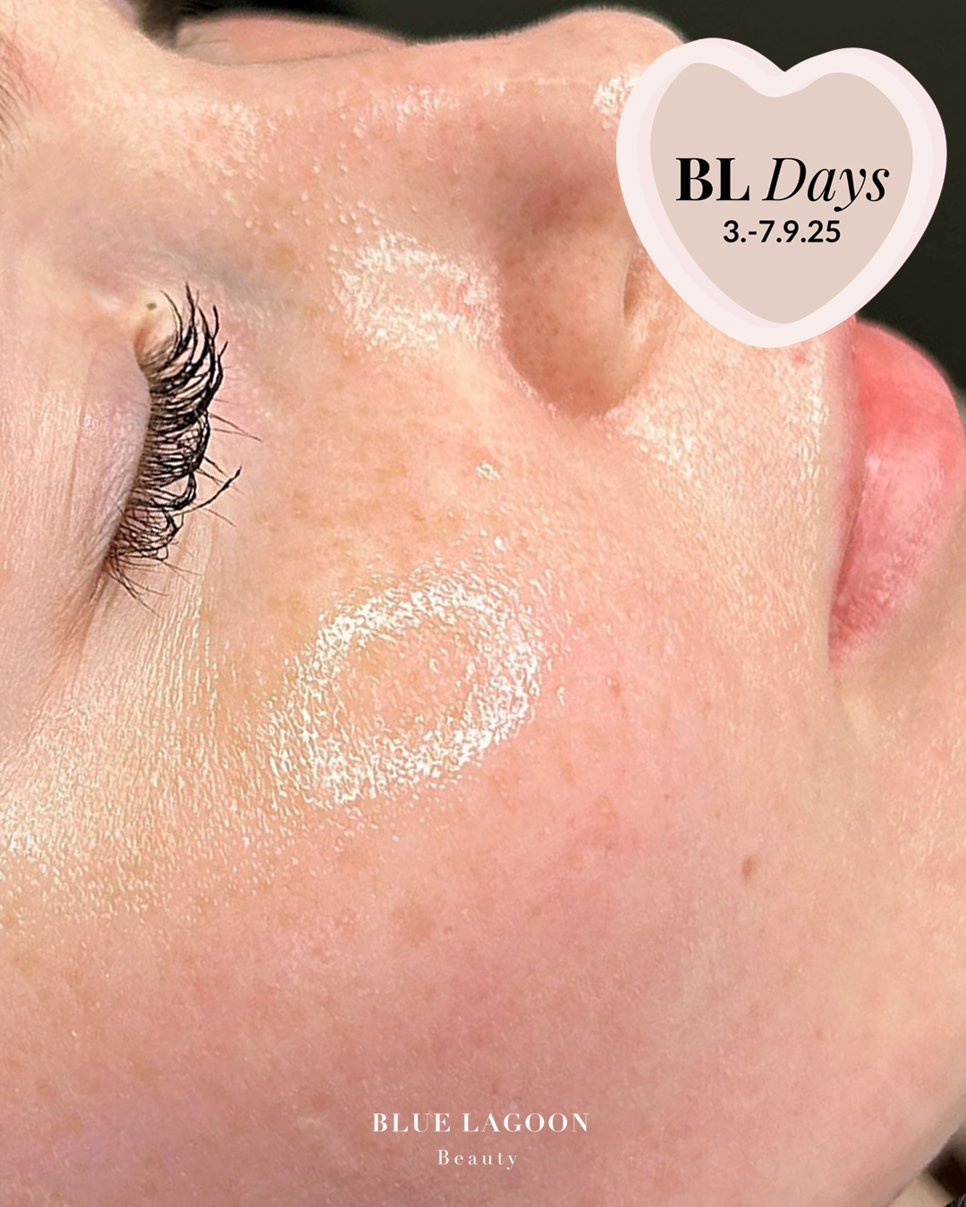 Tämän kuvan nimi on hydrafacial-signature-tarjous