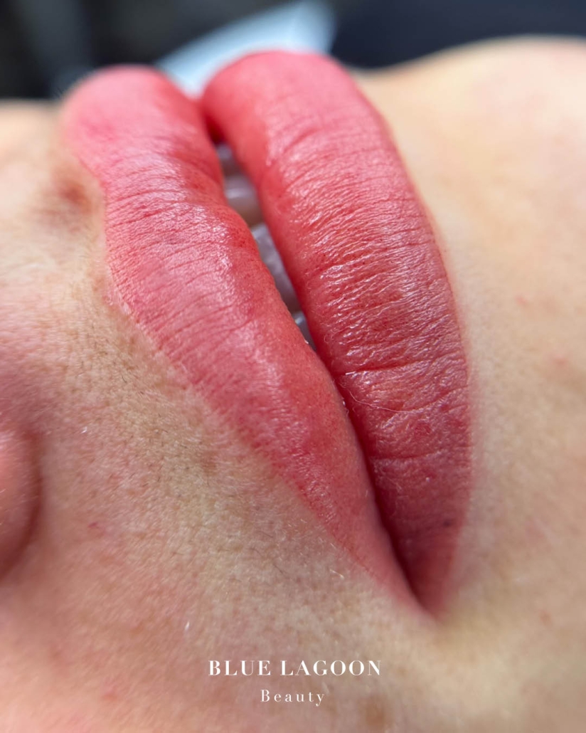 Tämän kuvan nimi on huulien-kestopigmentointi-bluelagoonbeauty