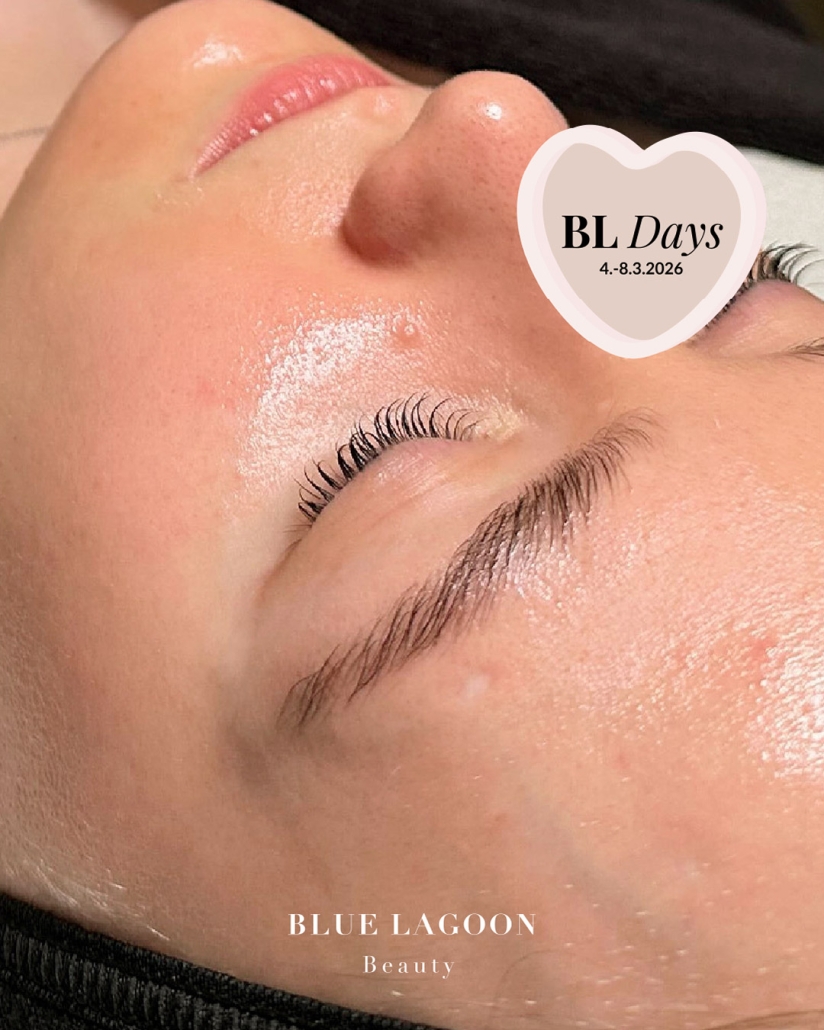 Tämän kuvan nimi on Hydrafacial