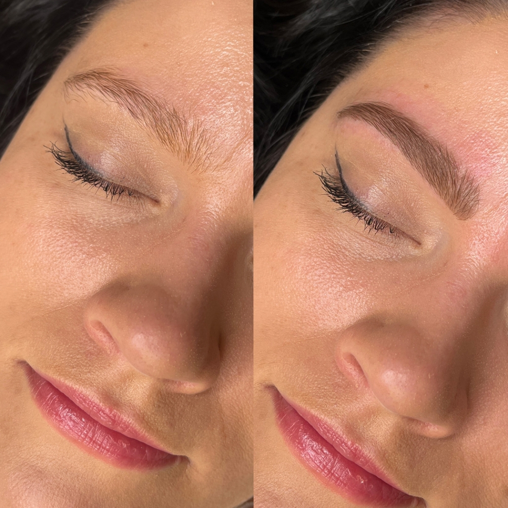 Here is an image of kestovarjays-bluelagoonbeauty