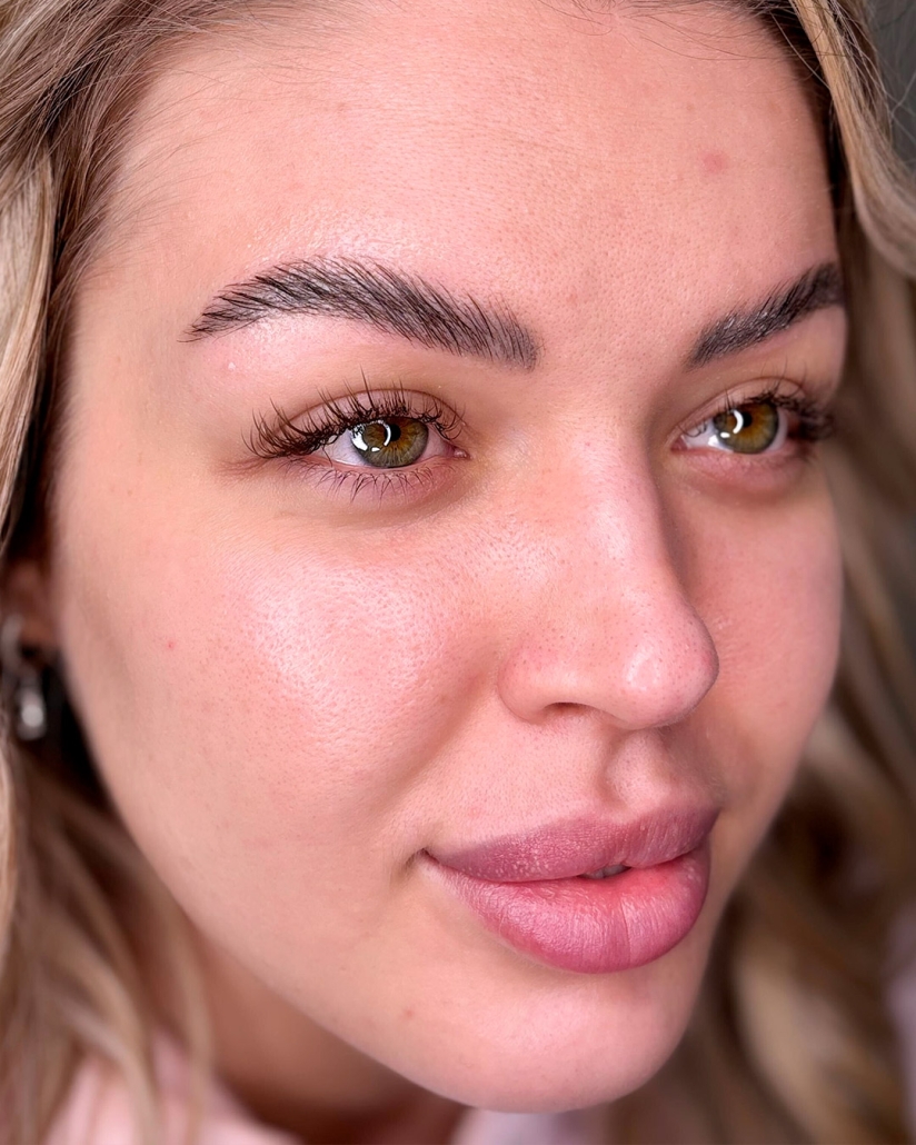 Tämän kuvan nimi on browlift-dianao-kamppi-bl (4)