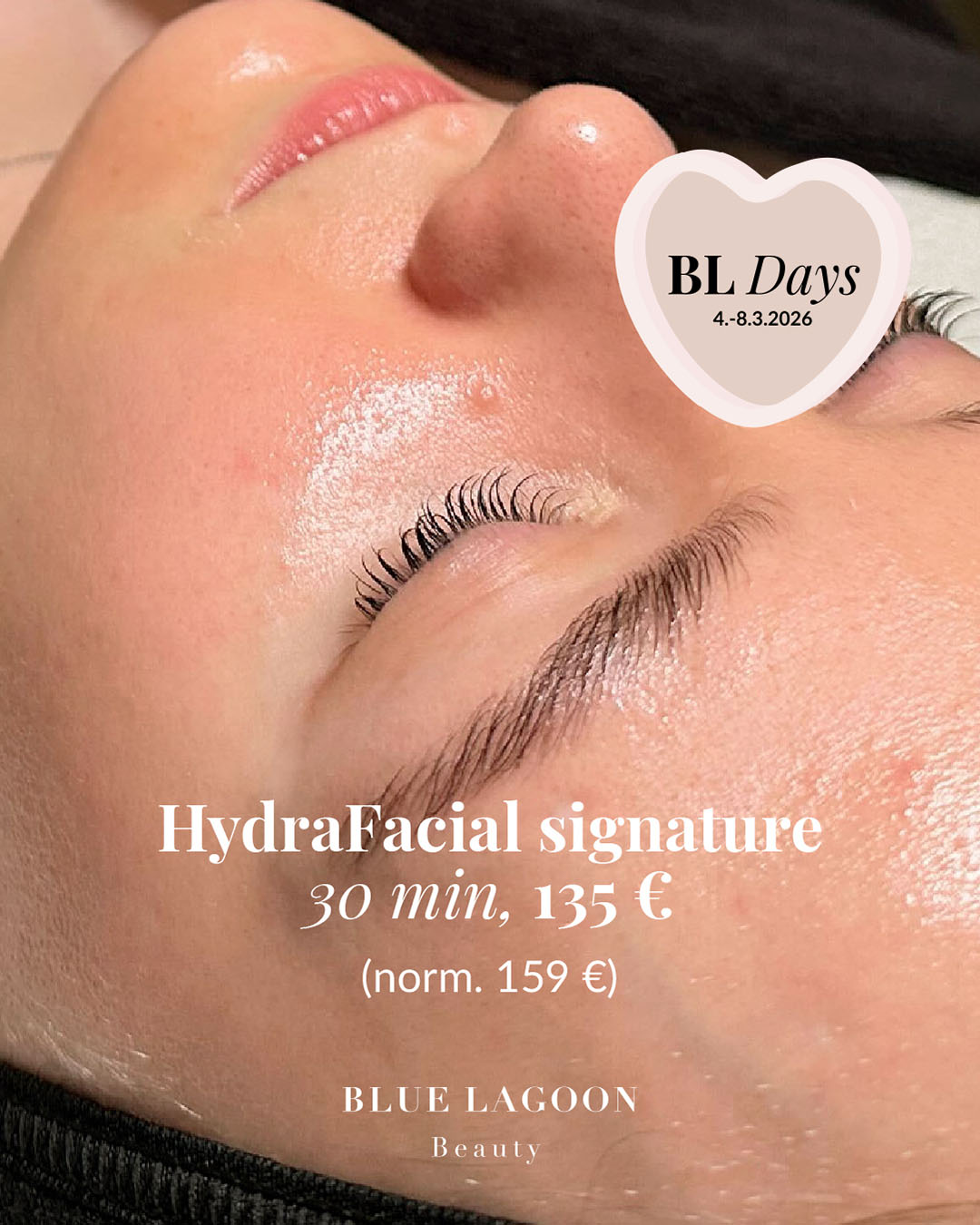 Tämän kuvan nimi on HydraFacial_1080x1350